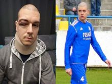 Futbalista Bolerázu Klačo je po úraze hlavy už v domácej liečbe