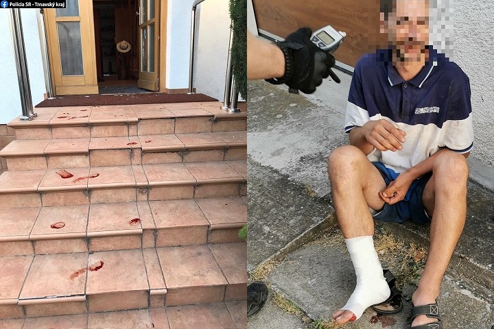 V Trnave na Kopánke muž rozkopal dvere do domu, utekal odtiaľ krvavý